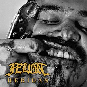Heridas
