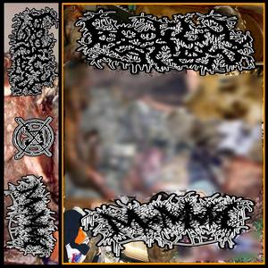 SEVERE GASTRIC VARICEAL HAEMORRHAGE (HYPEREMESIS)