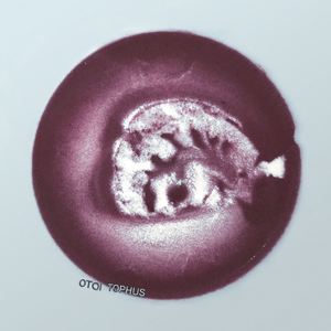 TOPHUS