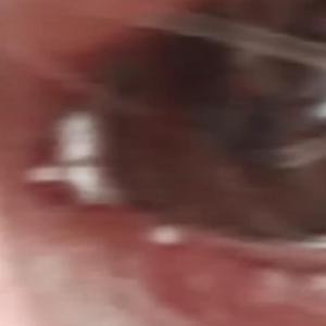 Kafamdaki sesler ölmemi istiyor