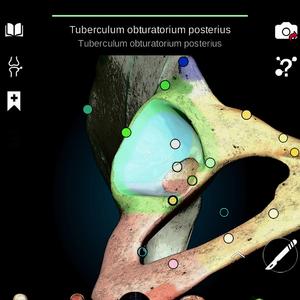 TUBERCULUM OBTURATORIUM POSTERIUS