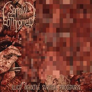 Illicit Infantile Surgical Procedures (Single)