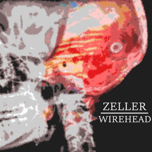 Wirehead