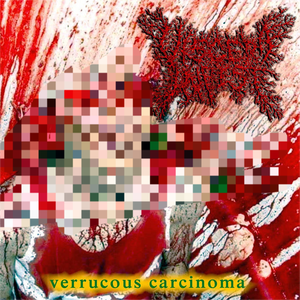 Naegleria Fowleri Micronema Deletrix Granulomatous Amebic EncepalitisPedicolosis