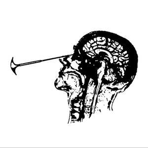 lobotomy (Super Slowed)