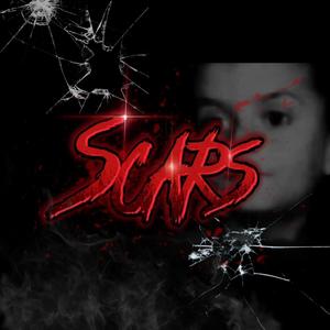 Scars