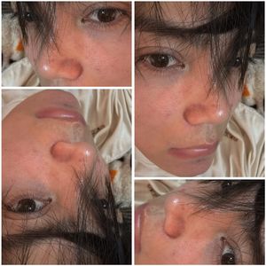 瞳孔（Eyes）