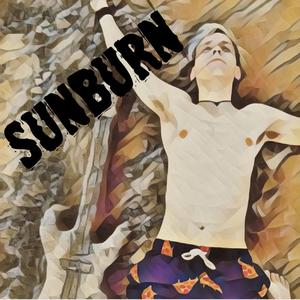 Sunburn
