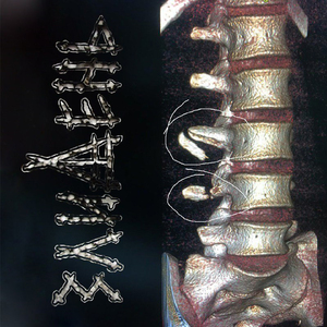 Хлопці, я зламав хребта!