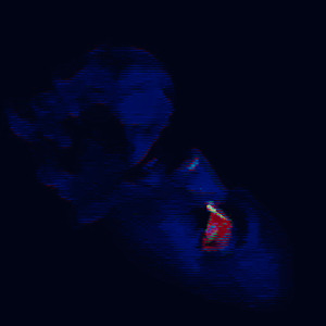 Serotonin (Dopamine II)