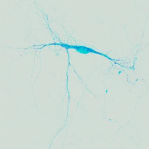 Mental Nebulosity (feat. Jeffery Willis)