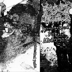 Sudden Death Due To Gastrointestinal Pain(Punctured Fetus Abdomen)