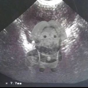 残酷月光（cover.林宥嘉）