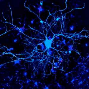 Choroid Plexus