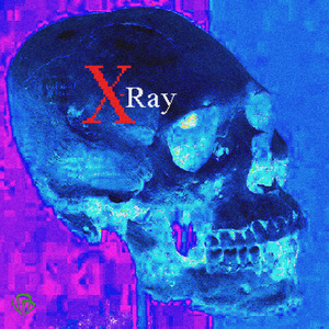 X-Ray