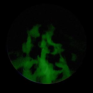 Overreacting (feat. vampvxy)