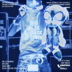 社区杀手（Prod.MECHO）