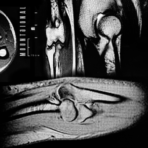 Medial