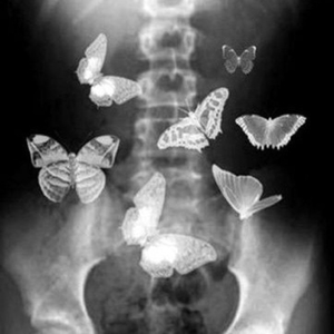 Borboletas