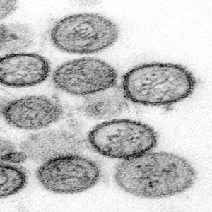 Hantavirus