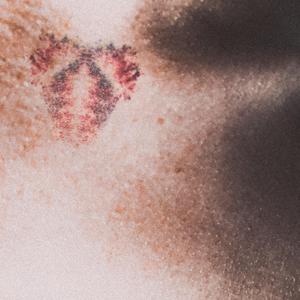 bruise (feat. 3nye & Von Arete)