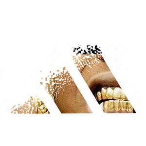 Fluxo Ad1dxs (feat. Graça & GGOSS)