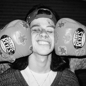 Cortada en la Frente