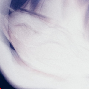 僕が人の形してていいわけない 傑作選 おすすめ 映科ゆらう - 助けて!延命してるのに一向にお前が死なないし僕は僕のままの間違った生き方をしていて世界全部間違っている