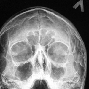 Черная масса