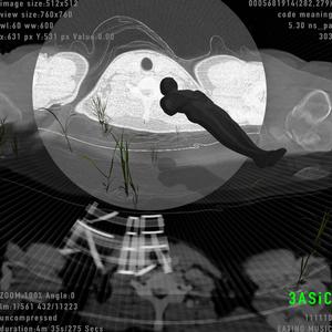 长眠（Eternal Rest）