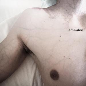Amputee