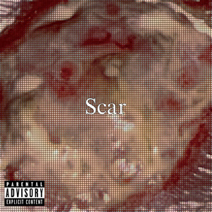 Scar