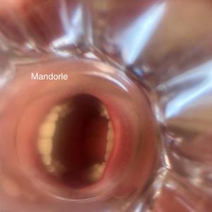 Mandorle