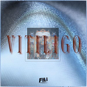 Vitiligo