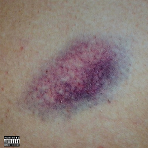 Синяки (feat. Vince Prince)