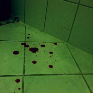 BloodParty