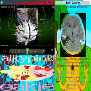 BRAIN DAMAGE (feat. oakie)