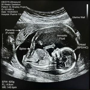 Psalm 139 (Metal Version)