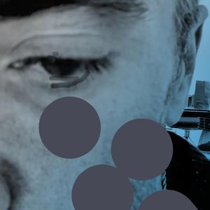 where did you get that scratch ?