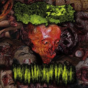 Irreversible Necrotizing Enterocolitis