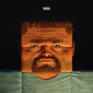 CONJONCTIVITE 2k25
