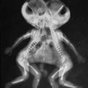 Siamese Twins (feat. BuckBoy)