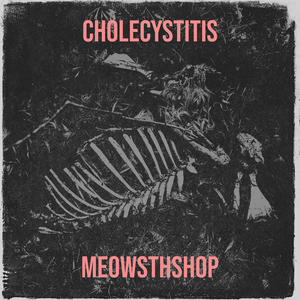 Cholecystitis