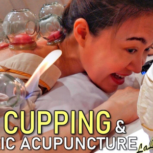 Cupping