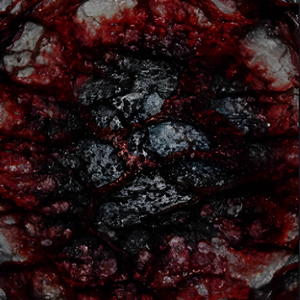 Leucotomia