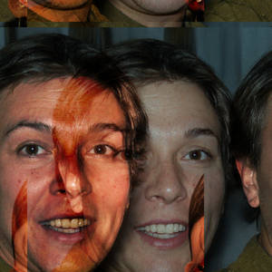 Broncho Tracheal