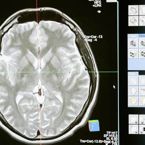 Trixking & Finesse