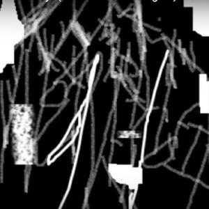 Placental Enema