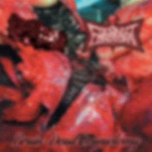 Malignant Epidermoid Carinoma