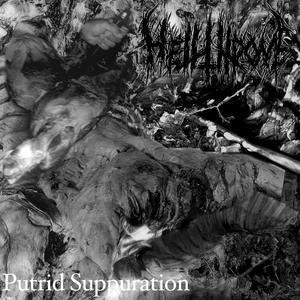 Putrid Suppuration